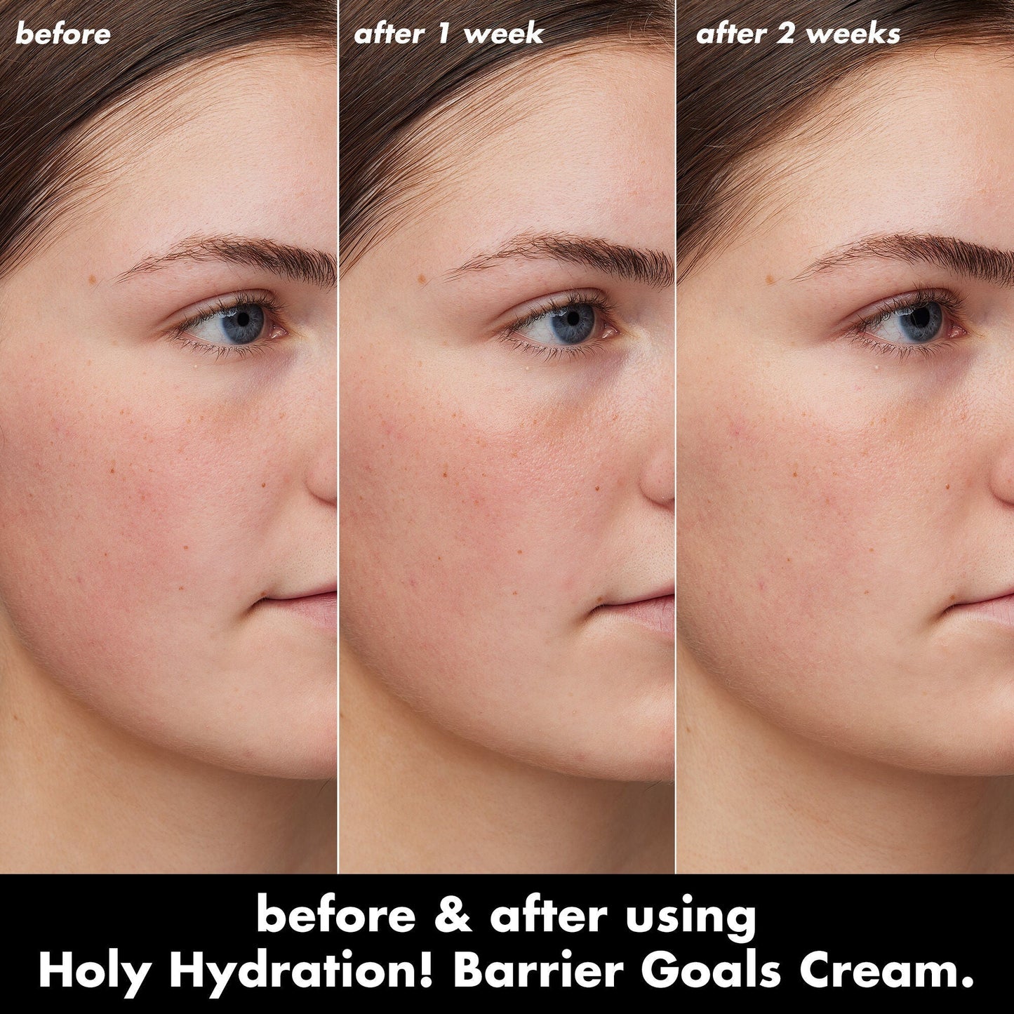 holy-hydration-barrier-goals-cream-t5 0226_EDU_HHBarrierGoalsCream_B_A_Zoe_TRYPTICH_710f5249-3a6b-41fd-89e4-817294dd9258.jpg