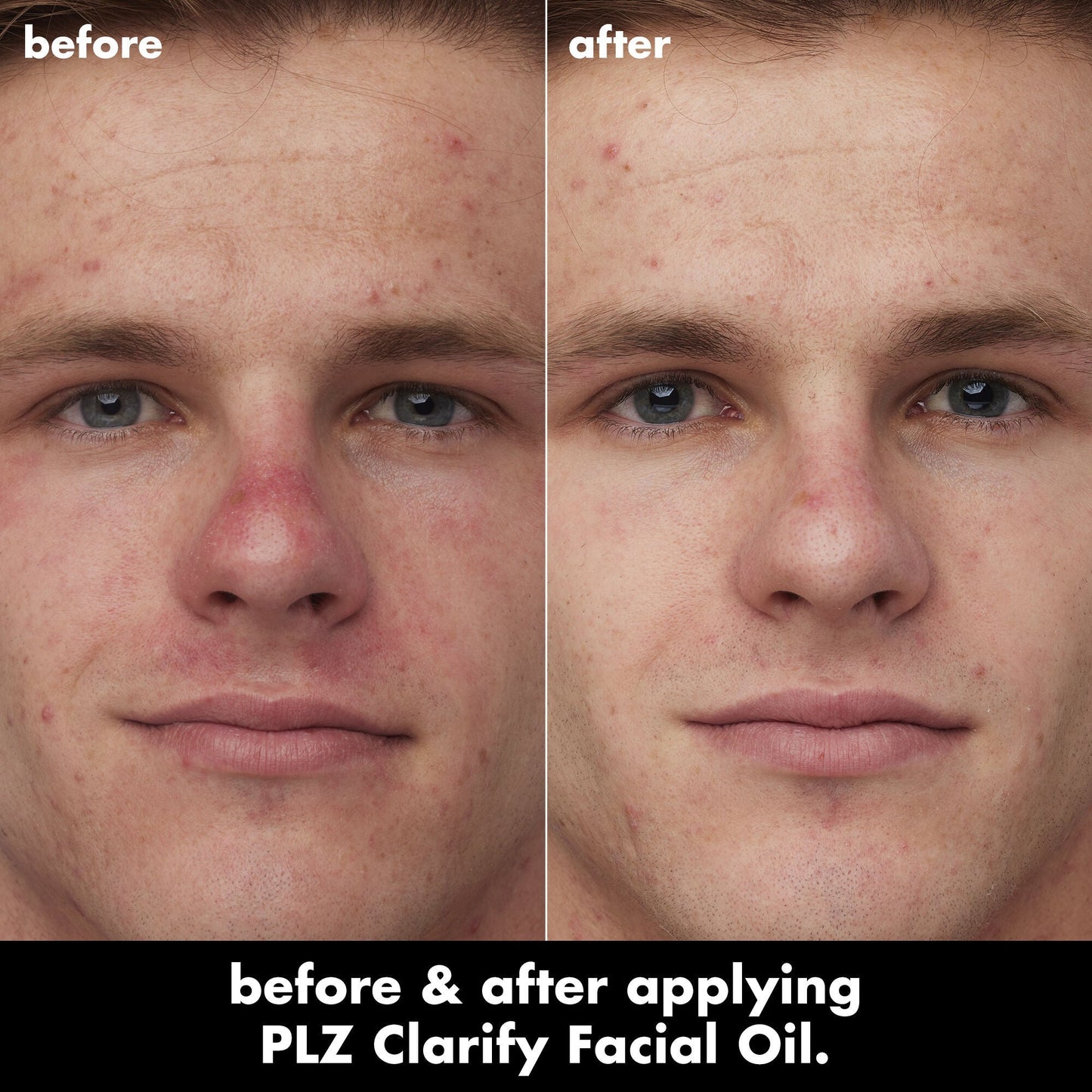plz-clarify-facial-oil-l2 0326_EDU_PlzClarify_BA_Caleb.jpg