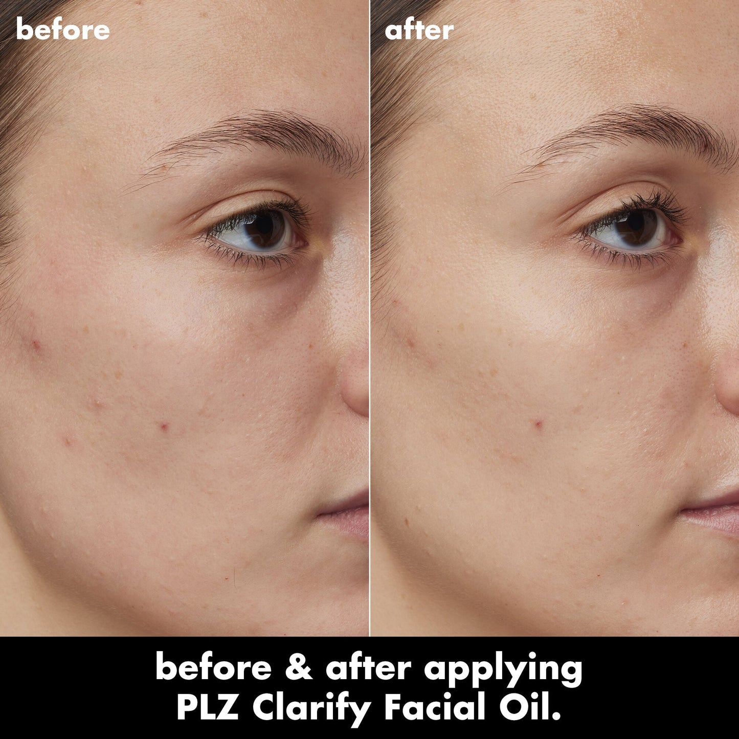 plz-clarify-facial-oil-l2 0326_EDU_PlzClarify_BA_Kelly.jpg