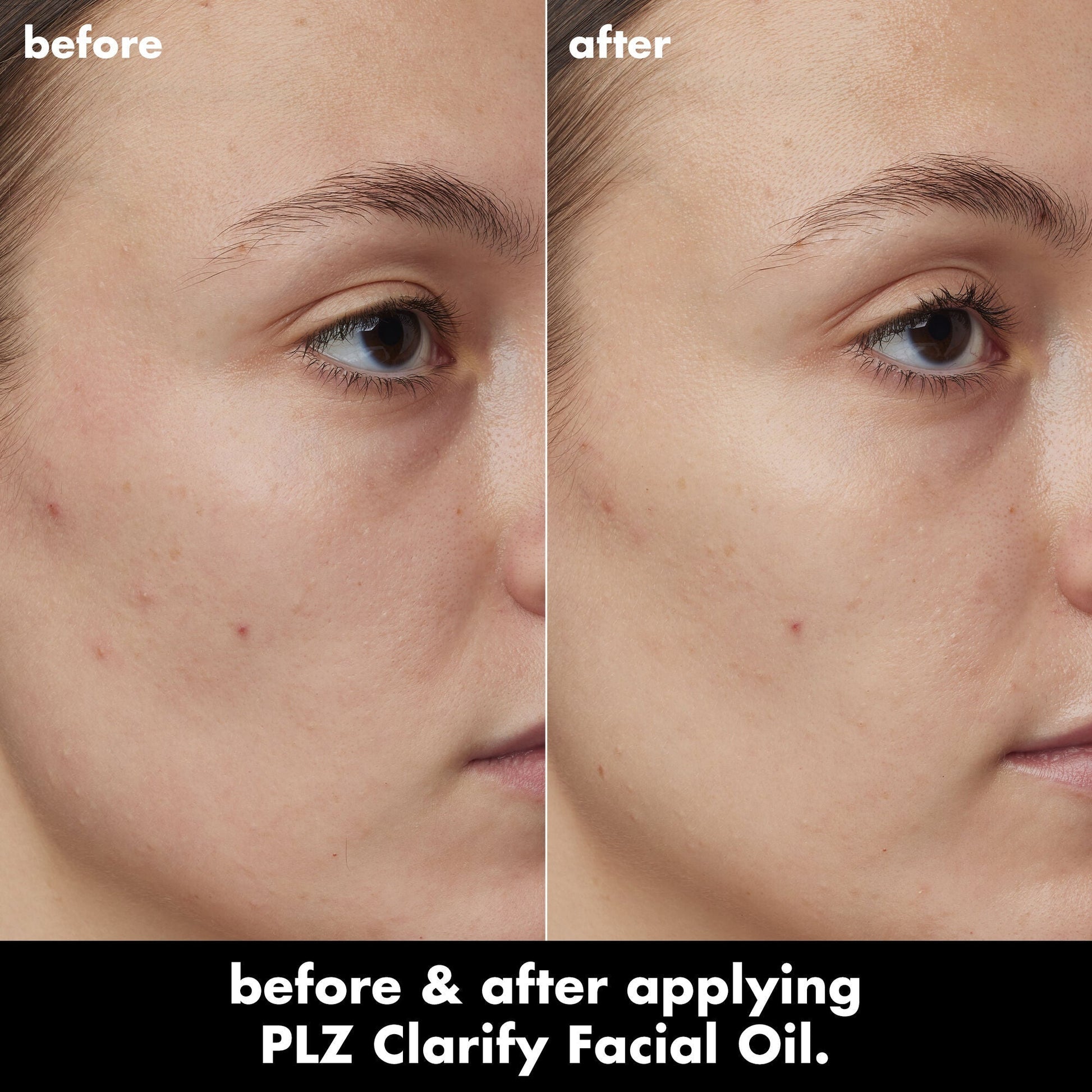 plz-clarify-facial-oil-l2 0326_EDU_PlzClarify_BA_Kelly.jpg