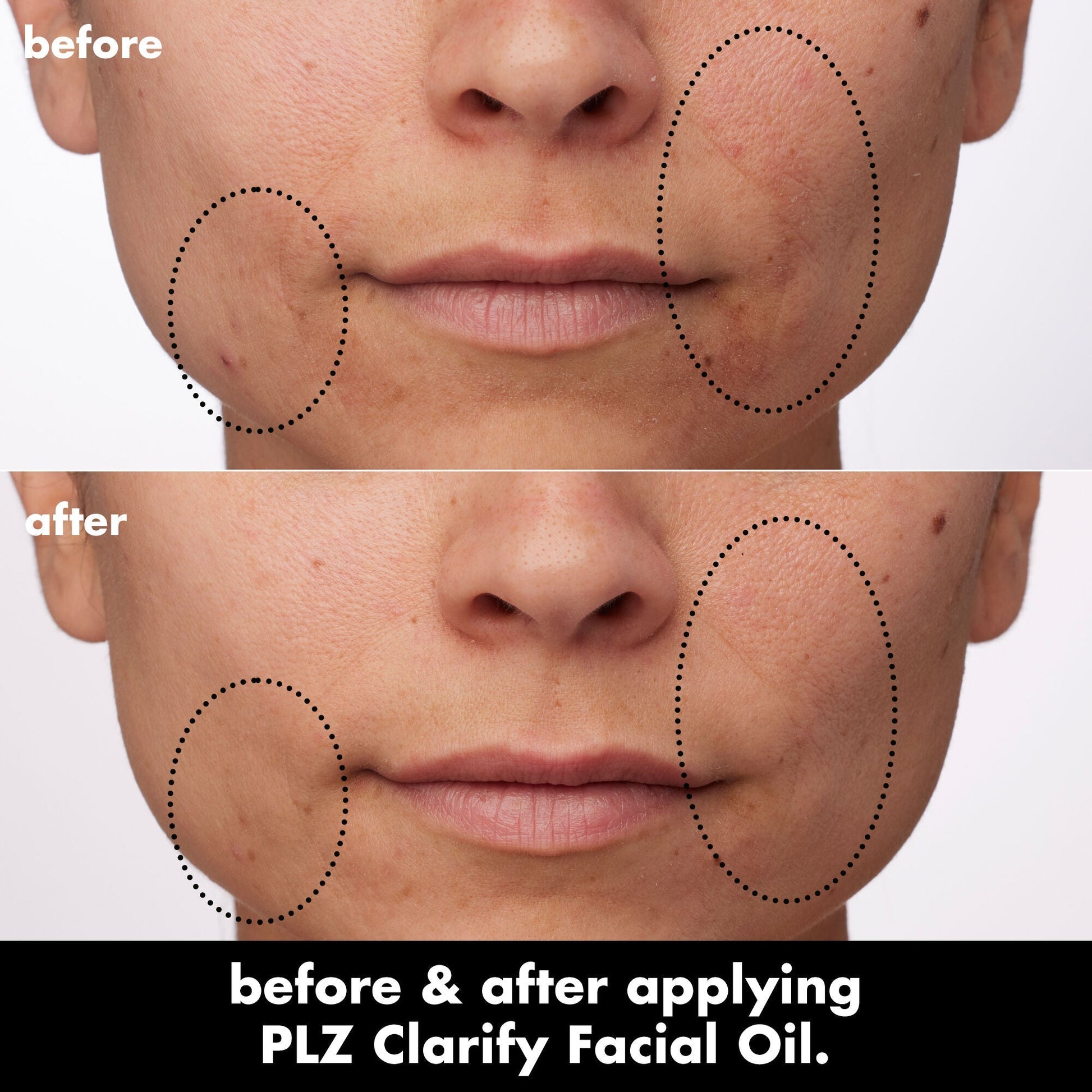 plz-clarify-facial-oil-l2 0326_EDU_PlzClarify_BA_Paula.jpg