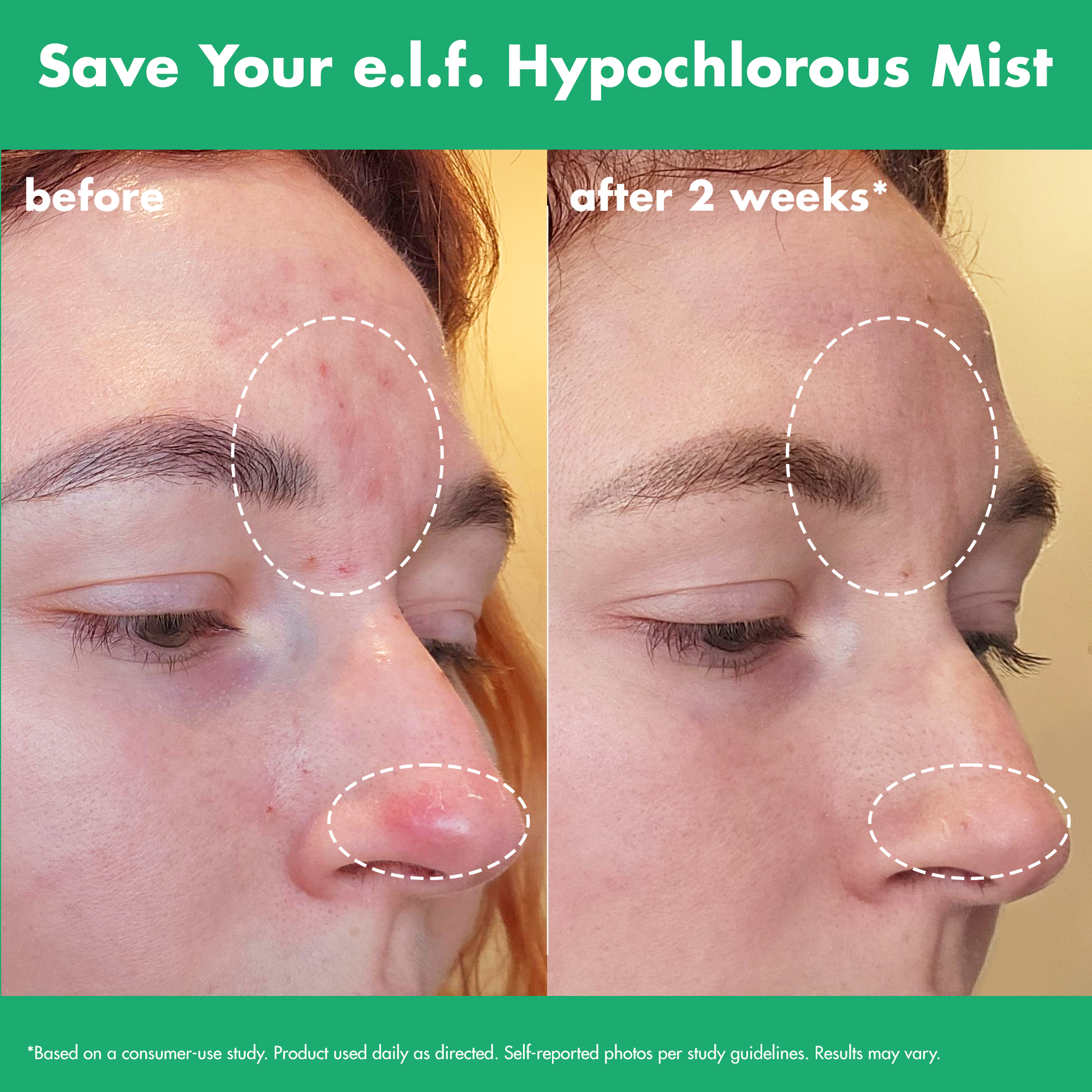 save-your-e-l-f-hypochlorous-mist-j8 FA26_EDUCATION_SAVEYOURELF_USAGE_BA1_WITHOUT_CLAIMS.png