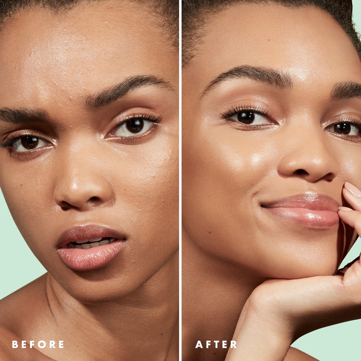 blemish-control-face-primer-large-size-s9 Primer_PP_Before_After_BlemishControl_2000x2000_3774231e-d4e1-49dd-b3d7-a73cbac901fe.jpg